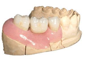 ceramiche