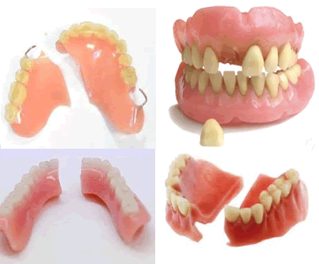 saldature_scheletrati_dentali