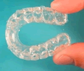 riparazione protesi  dentale roma  