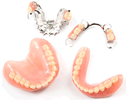 riparazione protesi o dentiera roma